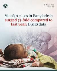 বাংলাদেশে হাম প্রাদুর্ভাব — একটি প্রতিরোধযোগ্য ট্র্যাজেডি